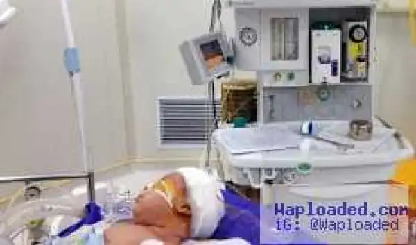 Photos: Doctor saves the life of a 35-day-old baby after head was sliced open by falling knife